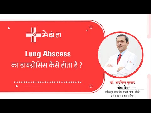  How is the diagnosis of Lung Abscess Done? | Dr. Arvind Kumar 